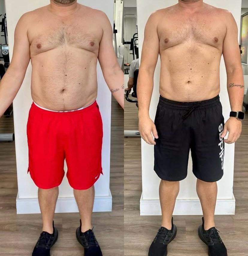 Antes e depois 1