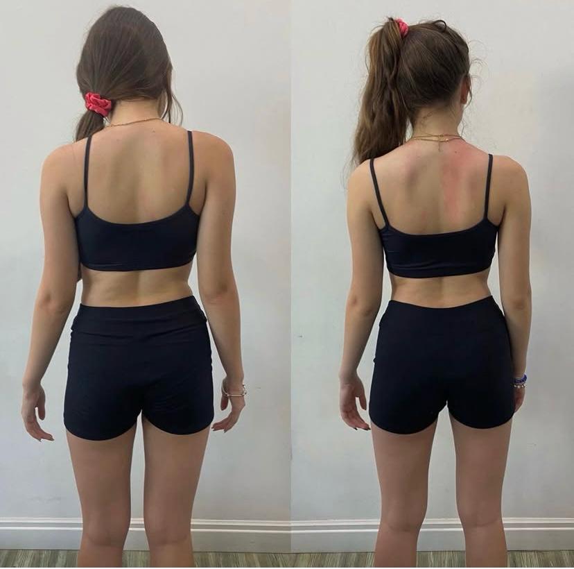 Antes e depois 2